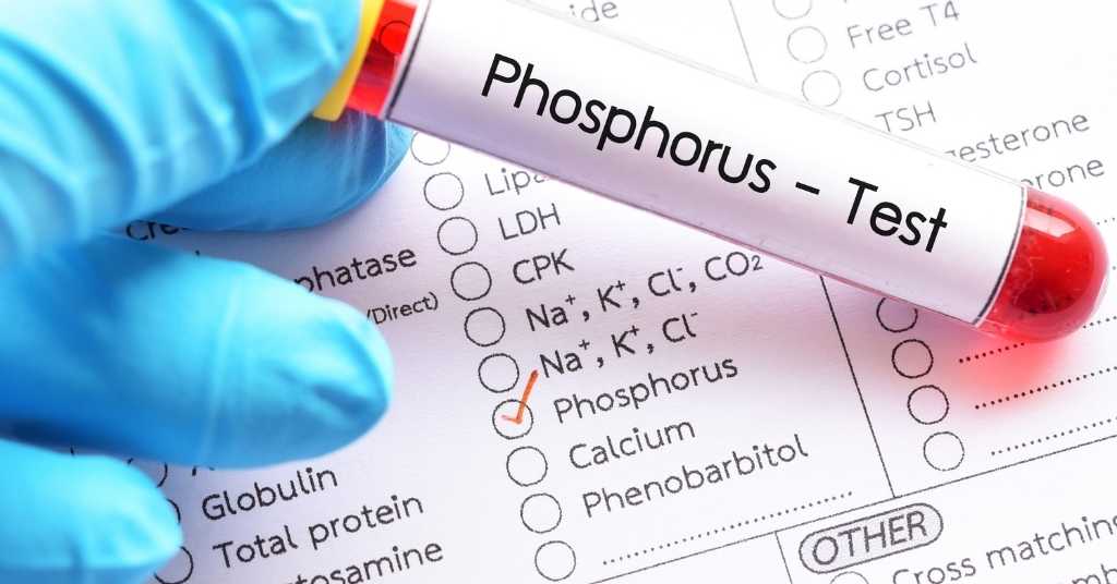 phosphorus level in blood test tube